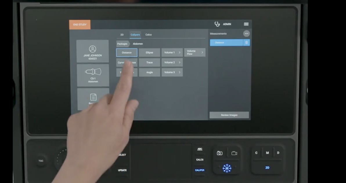 Image of person pointing to correct buttons to press when wanting to take measurements with the Sonosite LX