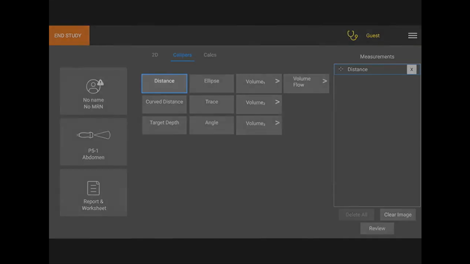 Picture of Sonosite PX menu on where to access the buttons to take measurements