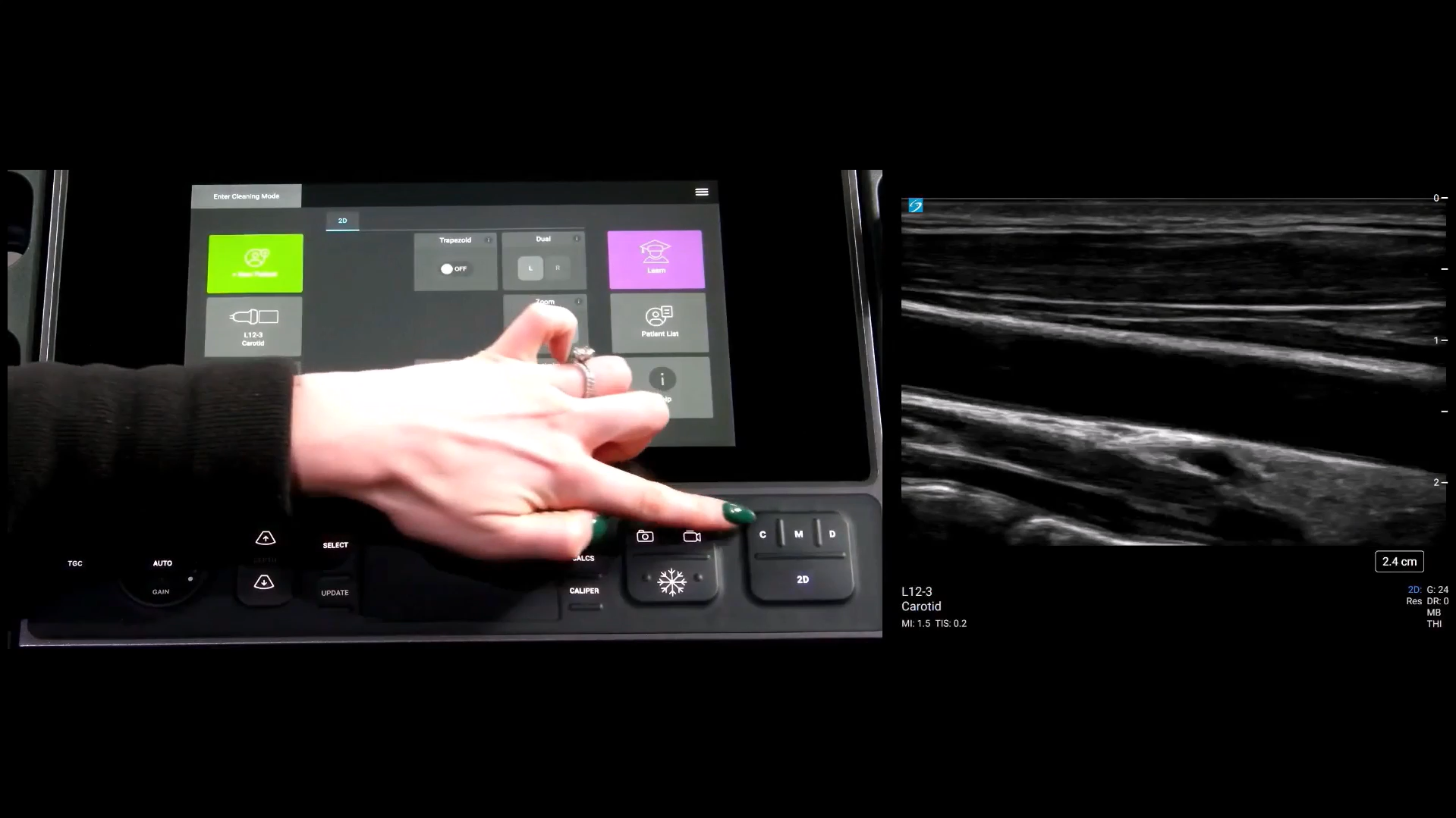 Picture of finger pointing at the correct button for color doppler activation