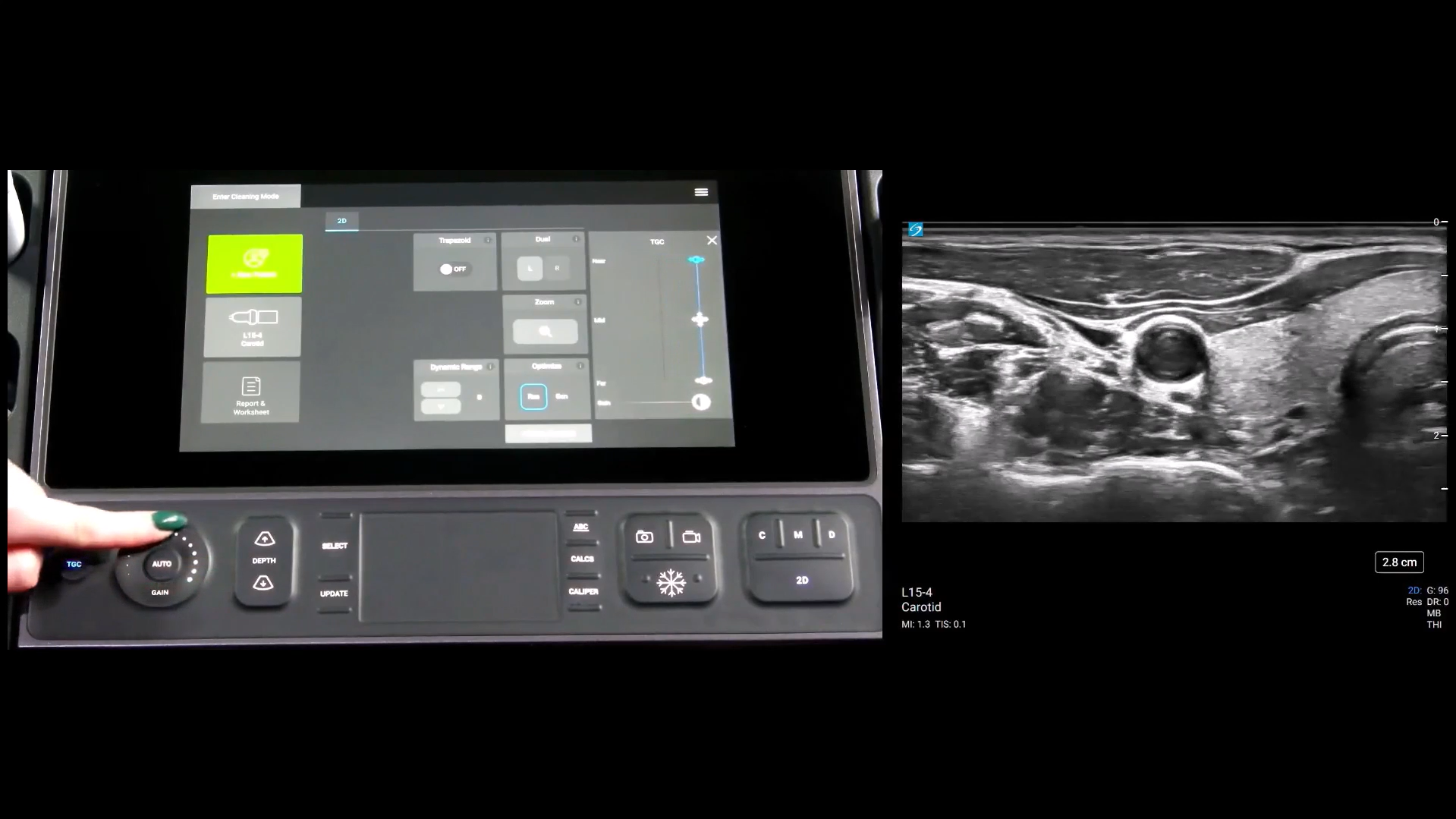 Picture of sonosite px interface for the gains and depth feature