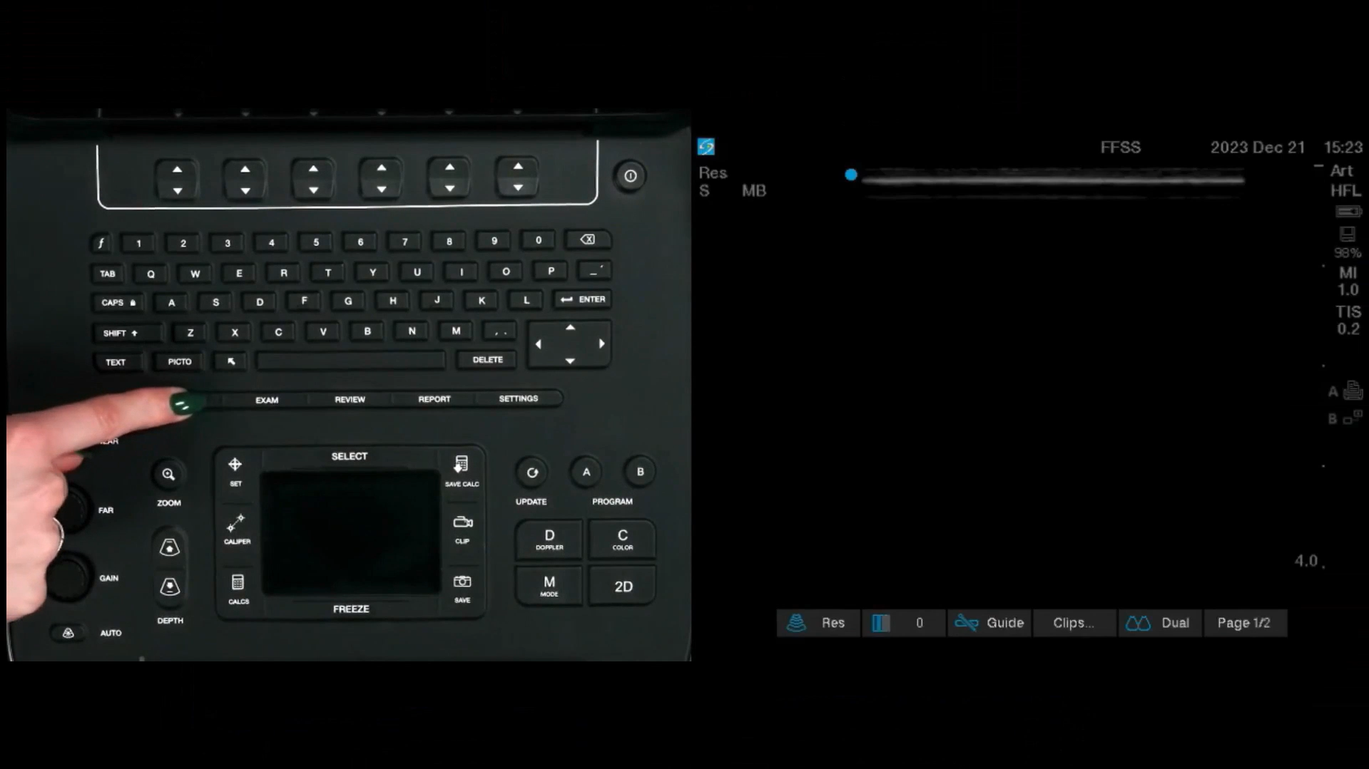 Picture of Sonosite Edge 2 with finger pointing in general place of the interface.