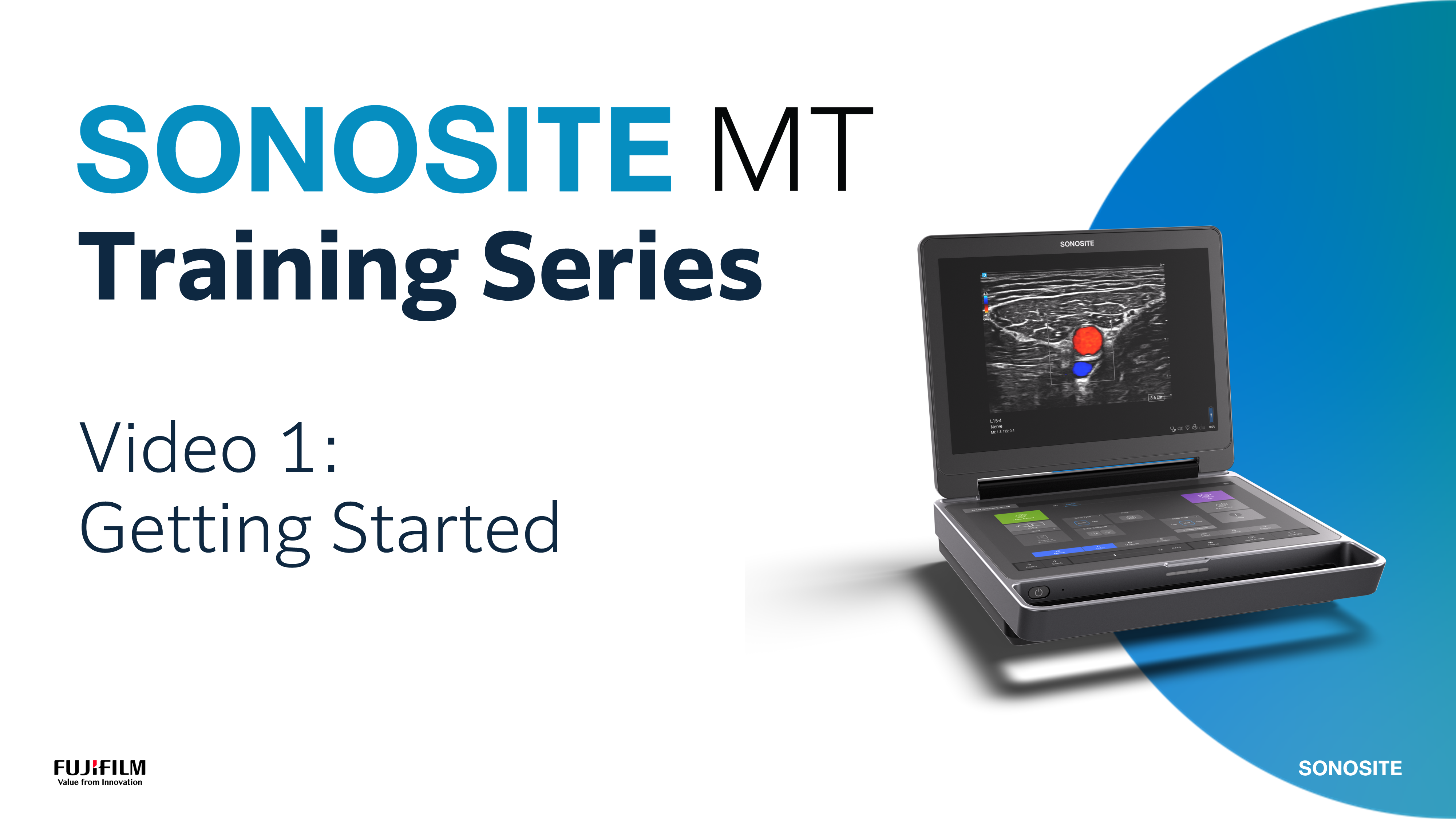 Sonosite MT Training Series Thumbnail