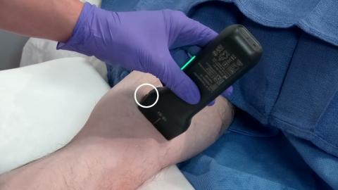  How to: Ultrasound Guided PICC Line