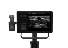 Sonosite iLOOK