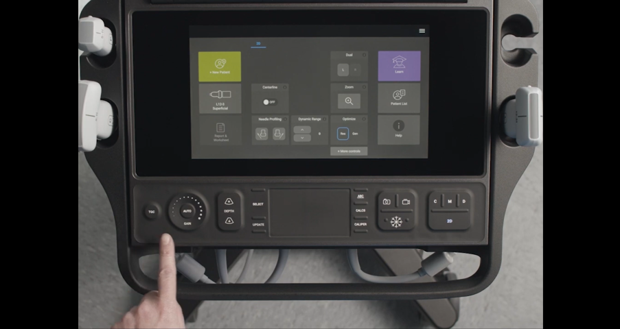 Picture of finger pointing to a button on Sonosite PX