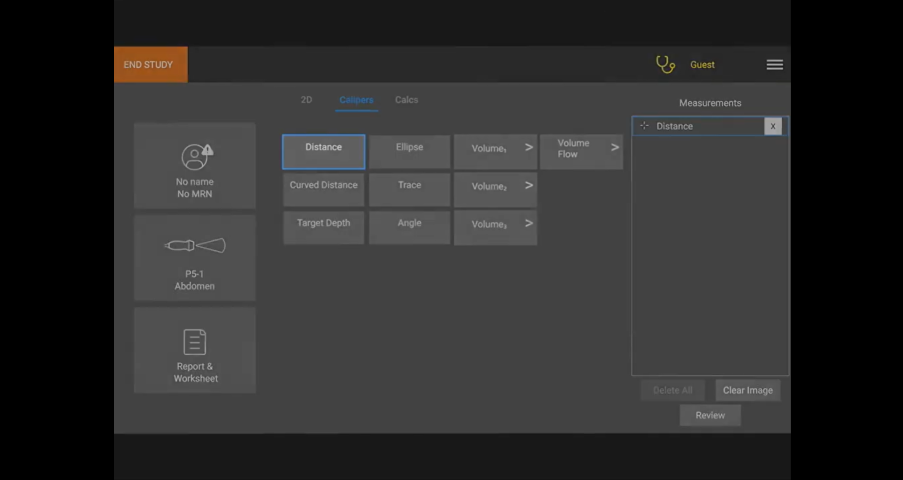 Picture of Sonosite PX menu on where to access the buttons to take measurements