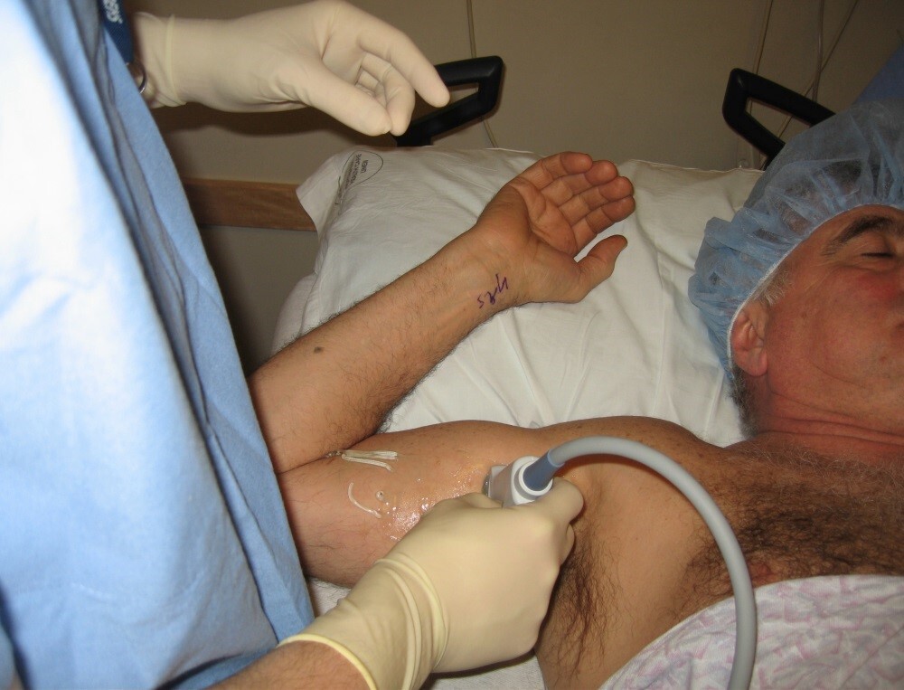 Axillary Patient Arm Position Graphic