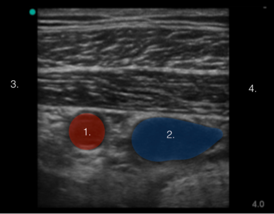 Artery and Vein Image