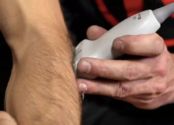 The Value of Using Ultrasound First for Musculoskeletal Imaging