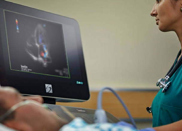 Ultraschall für eine präzise Bildgebung in der Kardiologie