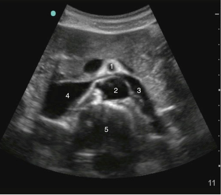 ultrasound-img