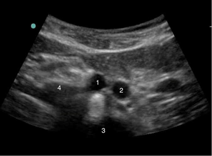 ultrasound-img