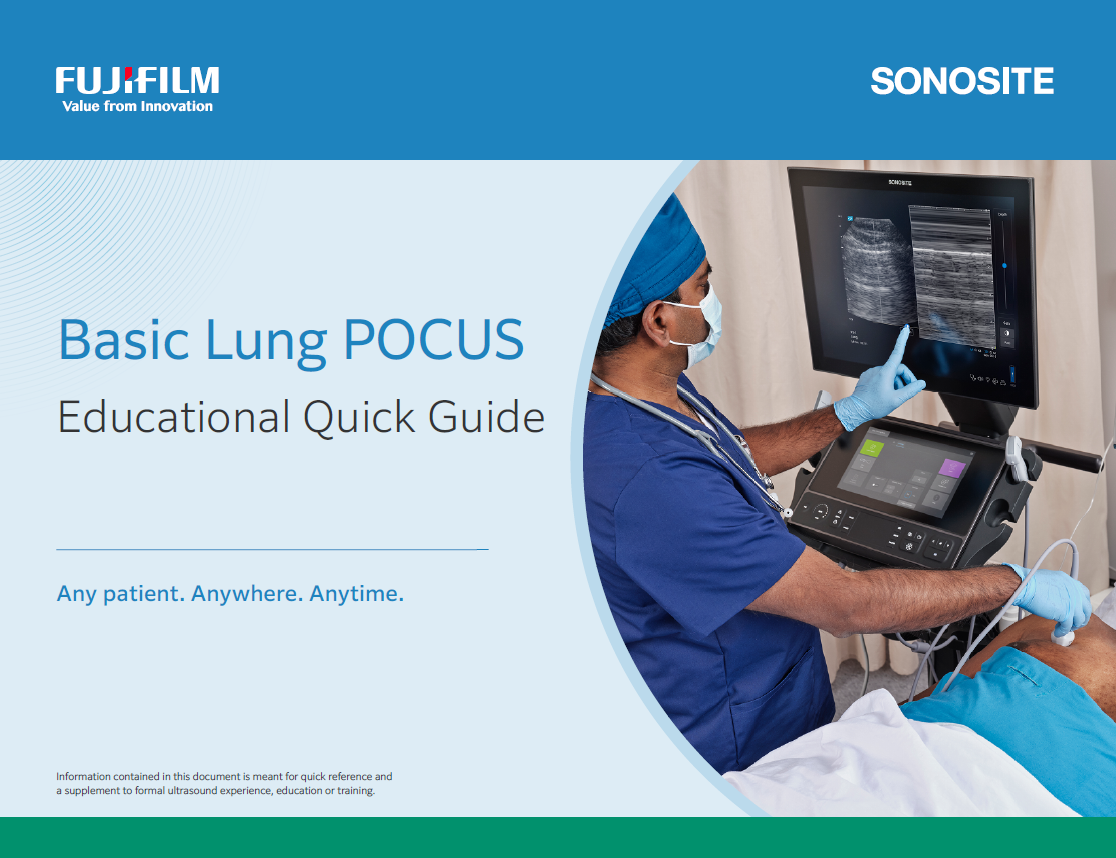 Basic Lung Ultrasound Quick Guide Thumbnail